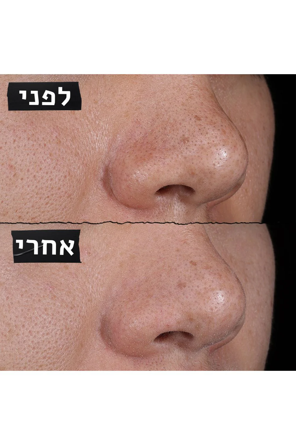 תמונה ממוזערת 6